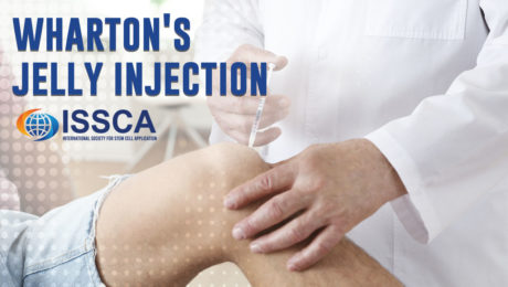 wharton jelly injection