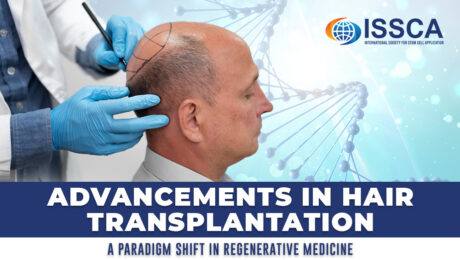 Advancements in Hair Transplantation A Paradigm Shift in Regenerative Medicine
