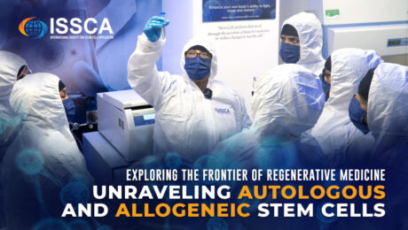 Exploring the Frontier of Regenerative Medicine Unraveling Autologous and Allogeneic Stem Cells